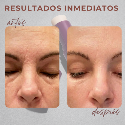 Avelié™ Instant Lift Balm – Stick Anti Arrugas Reafirmante